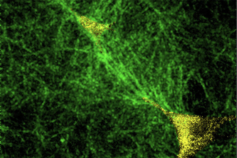 Tissue ‘tipping points’: How cells collectively switch from healthy to disease states