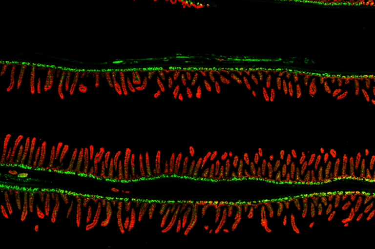 Gut bacteria linked to malnutrition may pass to younger generations